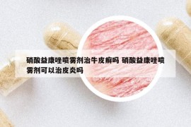 硝酸益康唑喷雾剂治牛皮癣吗 硝酸益康唑喷雾剂可以治皮炎吗