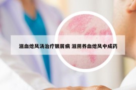 滋血熄风汤治疗银屑病 滋阴养血熄风中成药