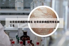 北京皮肤病医院排名 北京皮肤病医院排名前三名