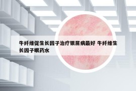 牛纤维促生长因子治疗银屑病最好 牛纤维生长因子眼药水