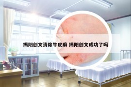 揭阳创文清除牛皮癣 揭阳创文成功了吗