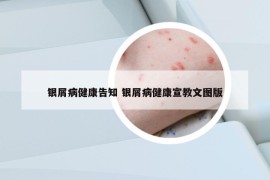 银屑病健康告知 银屑病健康宣教文图版