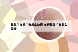 粘贴牛皮癣广告怎么处理 车辆粘贴广告怎么处理