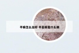 平癣怎么治好 平苔藓是什么病