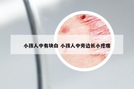 小孩人中有块白 小孩人中旁边长小疙瘩