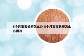 8个月宝宝长癣怎么办 8个月宝宝长癣怎么办图片