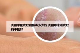 贵阳中医皮肤病排毒多少钱 贵阳哪家看皮肤的中医好