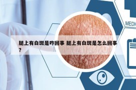 腿上有白斑是咋回事 腿上有白斑是怎么回事?