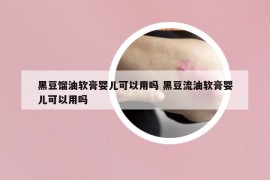 黑豆馏油软膏婴儿可以用吗 黑豆流油软膏婴儿可以用吗