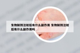 生物制剂注射后有什么副作用 生物制剂注射后有什么副作用吗