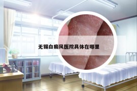 无锡白癜风医院具体在哪里