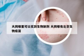 大同哪里可以买到生物制剂 大同哪有北京生物疫苗