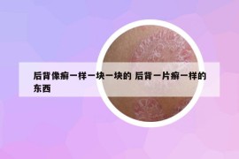 后背像癣一样一块一块的 后背一片癣一样的东西