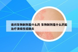 请问生物制剂是什么药 生物制剂是什么药能治疗溃疡性结肠炎