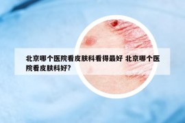 北京哪个医院看皮肤科看得最好 北京哪个医院看皮肤科好?