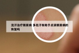 流汗治疗银屑病 多出汗有助于点滴银屑病的恢复吗