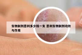 生物制剂恩利多少钱一支 恩利生物制剂功效与作用