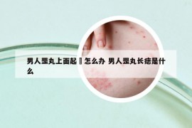 男人罡丸上面起廯怎么办 男人罡丸长痣是什么