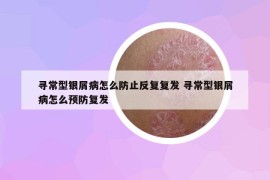 寻常型银屑病怎么防止反复复发 寻常型银屑病怎么预防复发