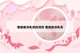 银屑癣净乳膏的功效 银屑藓净乳膏