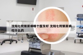 沈阳七院银屑病哪个医生好 沈阳七院银屑病吃什么药