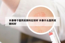 长春哪个医院皮肤科比较好 长春什么医院皮肤科好