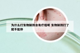 为什么打生物制剂会有疗程呢 生物制剂打了就不能停