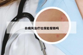 白癜风治疗社保能报销吗