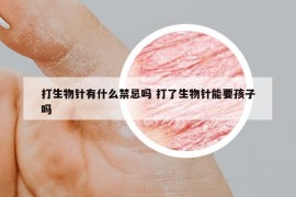 打生物针有什么禁忌吗 打了生物针能要孩子吗