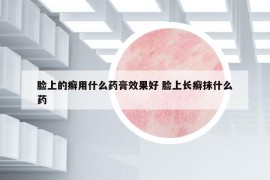 脸上的癣用什么药膏效果好 脸上长癣抹什么药