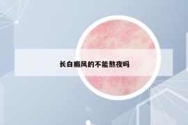 长白癜风的不能熬夜吗