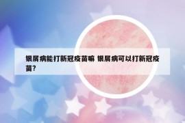 银屑病能打新冠疫苗嘛 银屑病可以打新冠疫苗?