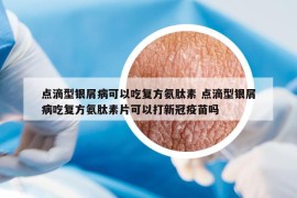 点滴型银屑病可以吃复方氨肽素 点滴型银屑病吃复方氨肽素片可以打新冠疫苗吗