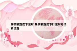 生物制剂皮下注射 生物制剂皮下针注射方法和位置