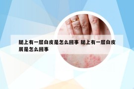 腿上有一层白皮是怎么回事 腿上有一层白皮屑是怎么回事