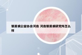 银屑病公益协会河南 河南银屑病研究所怎么样