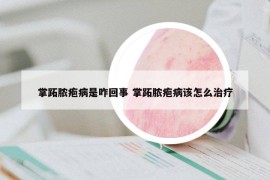 掌跖脓疱病是咋回事 掌跖脓疱病该怎么治疗