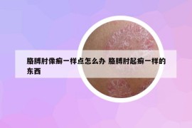 胳膊肘像癣一样点怎么办 胳膊肘起癣一样的东西