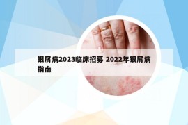 银屑病2023临床招募 2022年银屑病指南