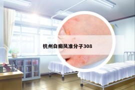 杭州白癜风准分子308