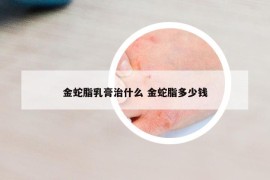 金蛇脂乳膏治什么 金蛇脂多少钱