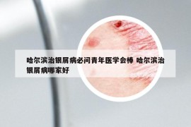 哈尔滨治银屑病必问青年医学会棒 哈尔滨治银屑病哪家好