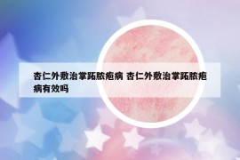 杏仁外敷治掌跖脓疱病 杏仁外敷治掌跖脓疱病有效吗