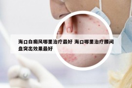 海口白癜风哪里治疗最好 海口哪里治疗腰间盘突出效果最好