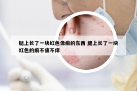 腿上长了一块红色像癣的东西 腿上长了一块红色的癣不痛不痒