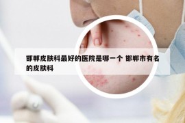 邯郸皮肤科最好的医院是哪一个 邯郸市有名的皮肤科