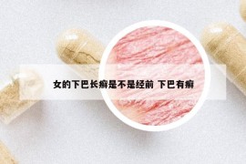 女的下巴长癣是不是经前 下巴有癣