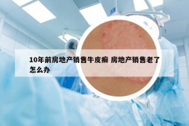 10年前房地产销售牛皮癣 房地产销售老了怎么办