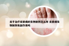 关于治疗皮肤病的生物制剂怎么样 皮肤病生物制剂有副作用吗