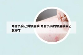 为什么自己得银屑病 为什么有的银屑病自己就好了